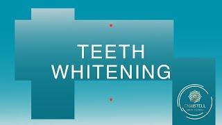 Teeth whitening - Christell Skin Clinic