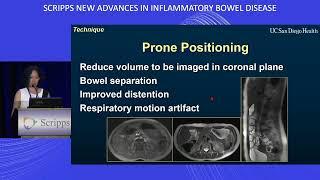 The Role of Imaging in IBD | Scripps Conference: New Advances in IBD 2023 Session