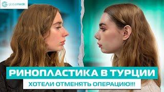 Операция пошла не по плану! Чем закончилась ринопластика в Турции?