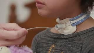Open Suctioning with a Tracheostomy Tube at Home