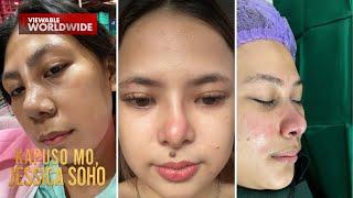 Ang pinag-ipunang Christmas wish na pagpapa-rhinoplasy, nabulilyaso! | Kapuso Mo, Jessica Soho