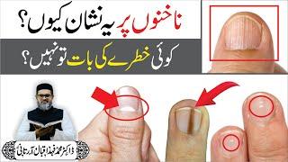 Nakhun ke SECRET MARKS || Dr. Fahad Artani Roshniwala