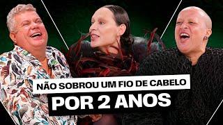 MILTON CUNHA COMENTA MONTAÇÃO QUE DEU ERRADO | AMBULATÓRIO DA M.O.D.A