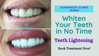 Dr. Carla Cyrino | Teeth Whitening Treatment in Dubai | Teeth Cleaning | Euromed® Clinic Dubai