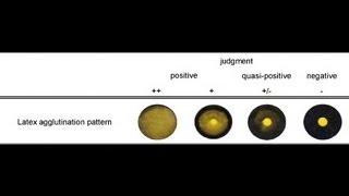 Latex Agglutination Test - Amrita University