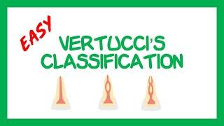 Vertucci's Classification for Root Canal Systems