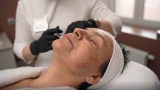 Facial Contouring with Novacutan at Seline Clinic | Performed by Dr. Tatyana Simonyan