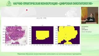 Практика обучения искусственного интеллекта на гистологических препаратах