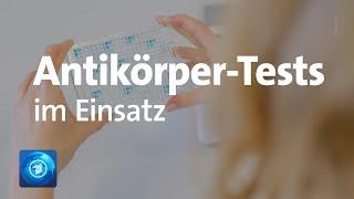 Antikörper-Testverfahren: Bayern startet Studie