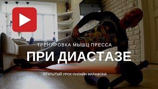 ДИАСТАЗ? Эти упражнения помогут вам вернуть красивый пресс!