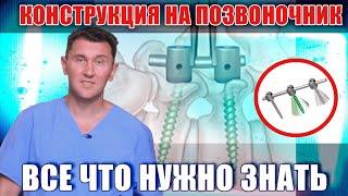 Конструкция на позвоночник может сломаться? Ответы на вопросы.