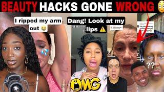 MERCY! BEAUTY HACKS GONE WRONG! COSMETIC TRAUMA DIY BEAUTY FAILS | TIK TOK COMP