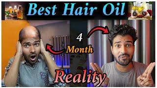 Reality of Original Adivasi Hair Oil (Hakki Pikki) | How to use Herbal Hair Oil | MIX SOLID MEDIA |