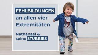 Dysmelie bzw. Fehlbildungen an allen 4 Gliedmaßen | Laufen mit Stubbies