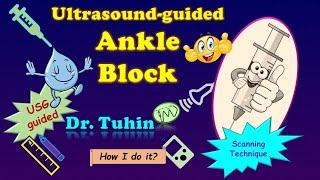 Ultrasound-guided Ankle Block | Scanning Principles | @DrTuhinM