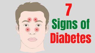 7 Early Signs Of Diabetes Most People Ignore