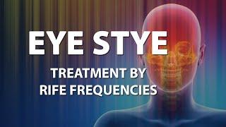 Eye Stye - RIFE Frequencies Treatment - Energy & Quantum Medicine with Bioresonance