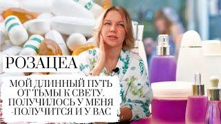 РОЗАЦЕА || ROSACEA || МОЯ ИСТОРИЯ БОЛЕЗНИ И ВЫЗДОРОВЛЕНИЯ || КОММЕНТАРИИ ДЕРМАТОЛОГА И КОСМЕТОЛОГА