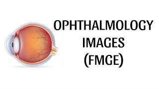 OPHTHALMOLOGY | IMAGES | FMGE #fmge #fmgejan2024 #fmge_mci_exam