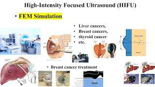 How Ultrasound Could Revolutionize Cancer Treatment