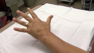 Mayo Clinic Minute: What may be causing your hands and feet to tingle
