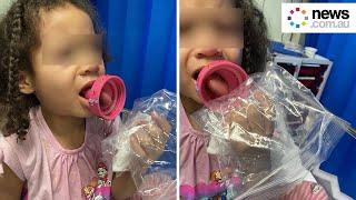 Mum's warning as girl's tongue stuck in bottle