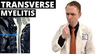 Neurologist Explains Transverse Myelitis