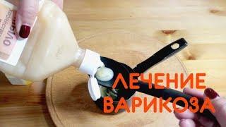 Забытое СРЕДСТВО от ВАРИКОЗА. Обязательно сохраняйте рецепт!