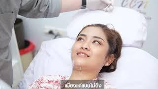 MFCU Laser เหนียงและแก้ม คุณกิ่ง ที่ CCN BANGKOK CLINIC