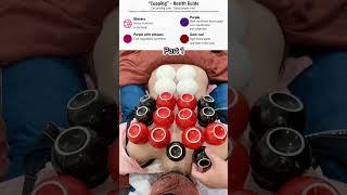 Health science: What do the different colors of cupping mean? #asmr #cupping #youtubeshorts #shorts