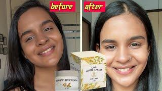 Omi white cream | Messo omi white cream review | Korean skin whitening cream