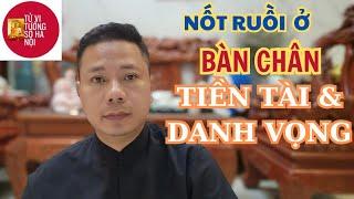 Nốt ruồi ở bàn chân báo hiệu tiền tài và danh vọng | Tử vi tướng số Hà Nội