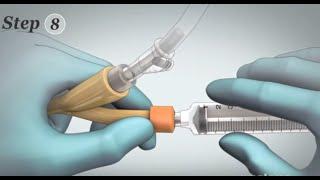 Removal of Foley Catheter (Male)