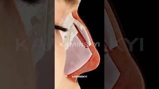 Structural & Preservation osteotomy rhinoplasty technique  #kaminskyi #kaminskyiedgar #rhinoplasty