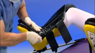 Allen Medical | Allen Stirrups | Instructional Video