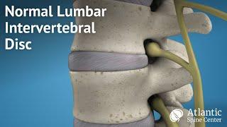 Normal Lumbar Intervertebral Disc