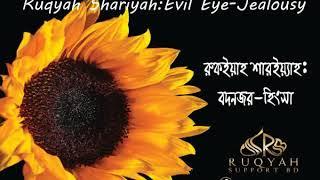 রুকইয়াহ বদনজর - Ruqyah Evil eye - বদনজরের রুকইয়াহ