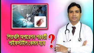 পিত্তথলির পাথর অপারেশন পরবর্তী লাইফস্টাইল কেমন হবে ?