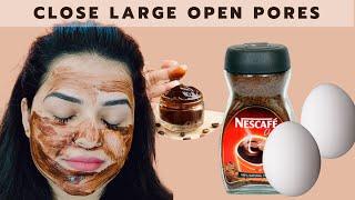 DIY Egg + Coffee Face Mask | Skin Whitening Face Pack - Close Large OPEN PORES & Remove Wrinkles