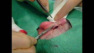 Skin surgery - mattress suturing