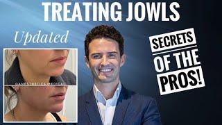 Injectors Guide: Treating the jowls with fillers