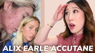 Dermatologist Reacts to Accutane Journey from Alix Earle | Side Effects, Hair Loss, Acne Recurrence