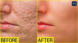 Face ko Smooth kaise kare | High - End Skin Retouching Photoshop Tutorial in Hindi | SABKE SAB