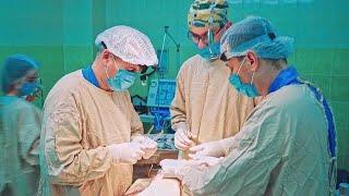 Surgeons Operate On Patient Stock Video