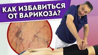 Как убрать ВАРИКОЗ? | Варикозное расширение вен — причины и лечение