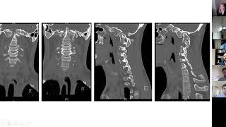 Virtual Global Spine Conference, April 13, 2020: Dr. Dahdaleh and Dr. Guiroy