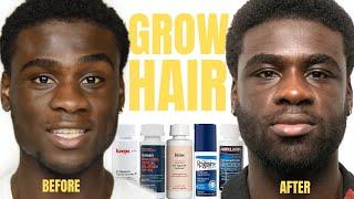 Hair Growth with Minoxidil The Truth