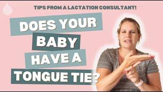 Does my baby have a TONGUE TIE? Here’s how to tell!