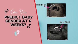 Can You Detect Baby's Gender at 6-8 Weeks Scan?  Boy or Girl?  The Ramzi Theory Gender Prediction