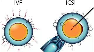 What is the difference between IVF & ICSI (Intracytoplasmic Sperm Injection)?